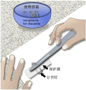 Basic remedial treatment - Paper materials: Metal fasteners with protective film